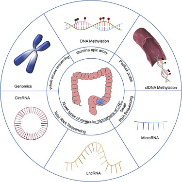 Novel Genetic and Epigenetic Biomarkers of Prognostic and Predictive Significance in Stage II/III Colorectal Cancer