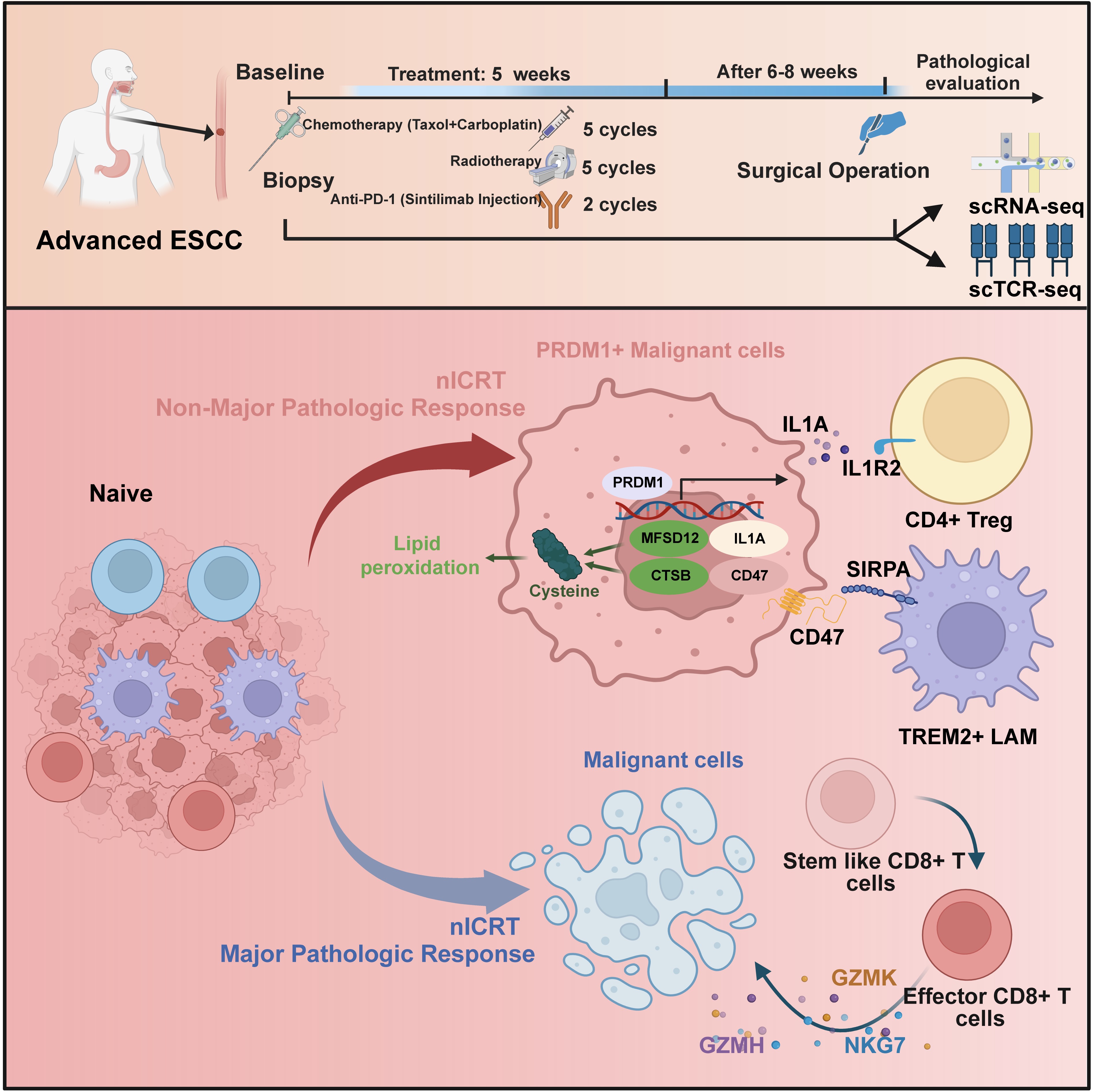 PRDM1+ Malignant Cells Mediate an Immunosuppressive Landscape and Resistance to Neoadjuvant Chemoradiotherapy and Immunotherapy in Esophageal Squamous Cell Carcinoma.